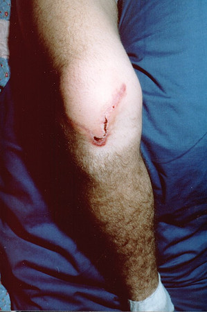 1989-04 - Stephen - After the wreck 2