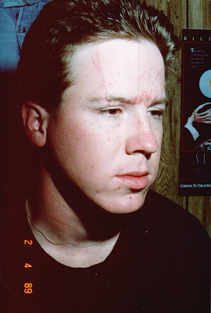 1989-04 - Stephen - After the wreck 3