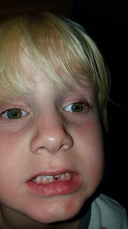2016-08-14 First Tooth 22