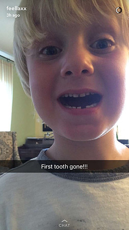 2016-08-14 First Tooth (by Felix)