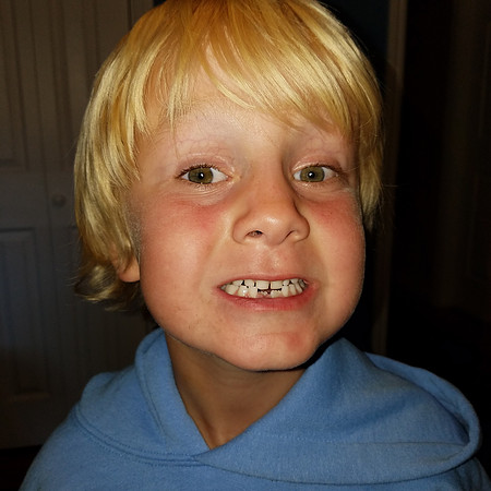 2016-09-17 Morning (Tooth Two) 02