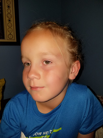2018-06-02 Braids 01
