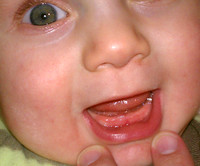 2011-01-22 First Tooth