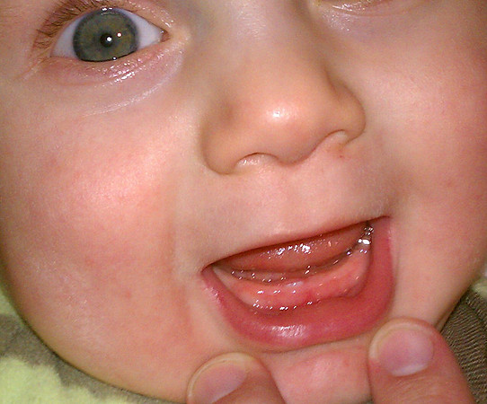 2011-01-22 First Tooth